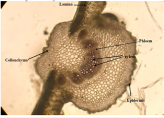 Fig: Microscopic Characters: T.S. of Adhatoda vasica leaf