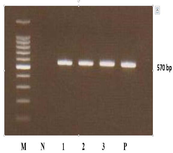 Agarose gel of the PCR product of Tiger grouper Epinephelus fuscoguttatus after experimental infection with Iridovirus. LANE M: DNA molecular weight marker (); LANE 1: Sample 1; LANE 2: Sample 2; LANE 3: Sample 3; LANE P: Positive control; LANE N: Negative Control.