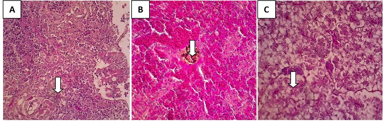 Histological analysis in different tissue of Tiger grouper Epinephelus fuscoguttatus following herbal bioconditioners to overcome the experimental infection with Grouper Iridovirus showing a necrosis in (a) intestine ; (b) kidney and (c) liver
