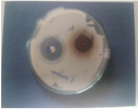 Agar diffusion test shows the zone of inhibition by Triphala (T) and methicillin (M) for Pseudomonas aeruginosa ATCC 27853.