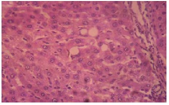 Liver section of group C animals (X 400) - Moderate vacuolar degeneration of hepatocytes 