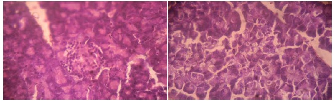 Pancreas section of group B animals (X 400) - Necrosis & atrophy of islets