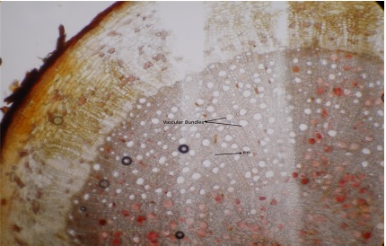 T.S of root of Ficus retusa. Linn showing vascular bundles and pith region